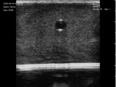 アルファバイオ株式会社 超音波ガイド下穿刺トレーニングでしたら