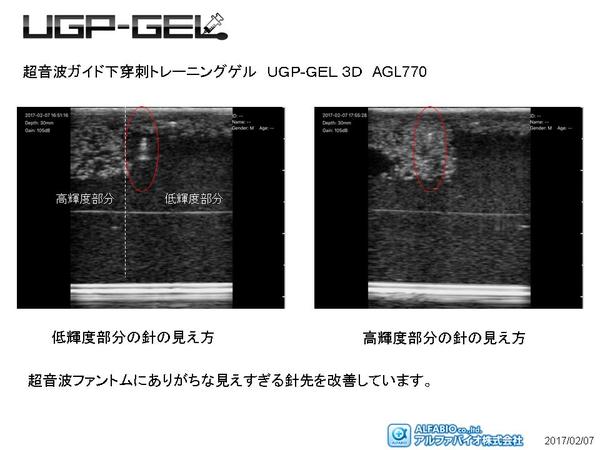 アルファバイオ株式会社 超音波ガイド下穿刺トレーニングでしたら