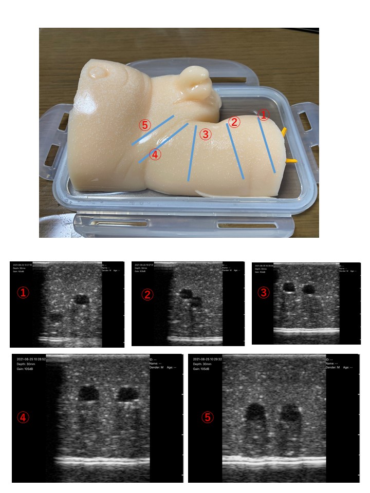 アルファバイオ株式会社 超音波ガイド下穿刺トレーニングでしたら