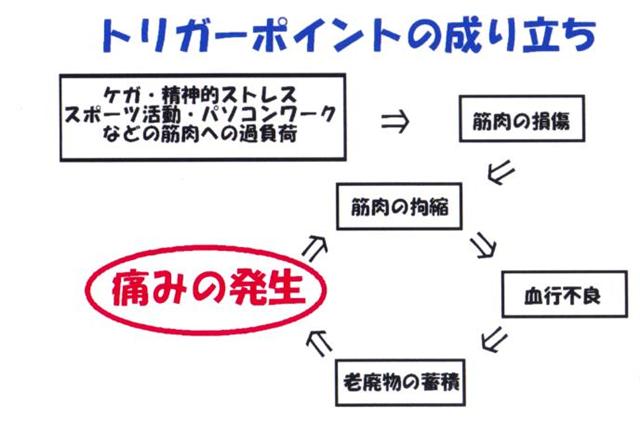 肩痛 腰痛 ひざ痛 痛みの専門 りらく堂整体院 トリガーポイントについて