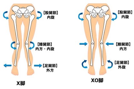 O脚x脚改善 美脚クリエイト スタイレックス ひまわり整体院 岩手県花巻市 マッサージ リラクゼー O脚x脚とは