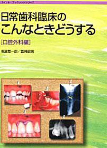 智歯の抜歯ナビゲーション
