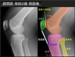 井上整骨院針灸院カイロ整体 膝関節痛