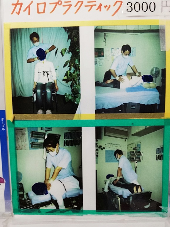 貴重オブジェ！カイロプラクティック！　整体！整骨！オステ！腰椎！矯正！貴重！ 貴重オブジェ！カイロプラクティック！ 整体！整骨！オステ