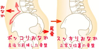 井上整骨院針灸院カイロ整体 尾骨痛