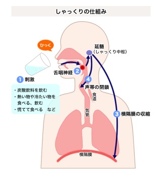 井上整骨院針灸院カイロ整体 シャックリ続く