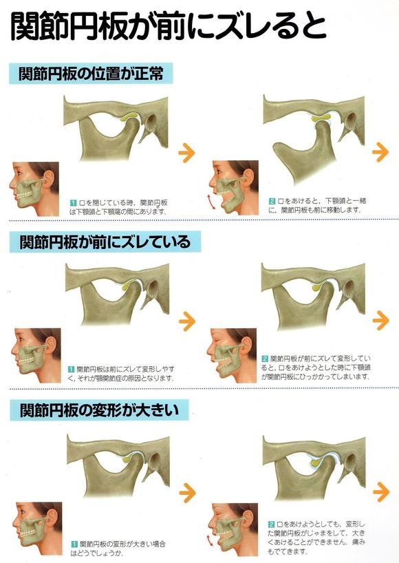 四肢・顎関節の調整 中島文保著 本