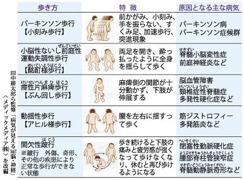 井上整骨院針灸院カイロ整体 歩行障害