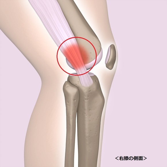 Sclerotome Pain 解剖図！カイロ！整体！鍼灸！エステ