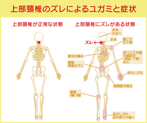 サイドポスチャーテーブル(上部頸椎カイロプラクティック) すばや