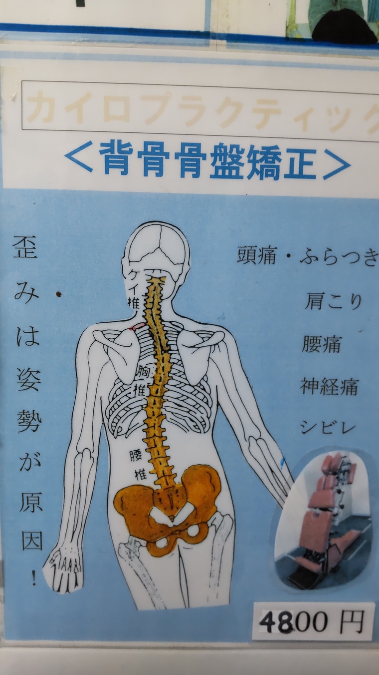 Sclerotome Pain 解剖図！カイロ！整体！鍼灸！エステ！トレーナー！ Sclerotome Pain 解剖図！カイロ！整体！鍼灸！エステ