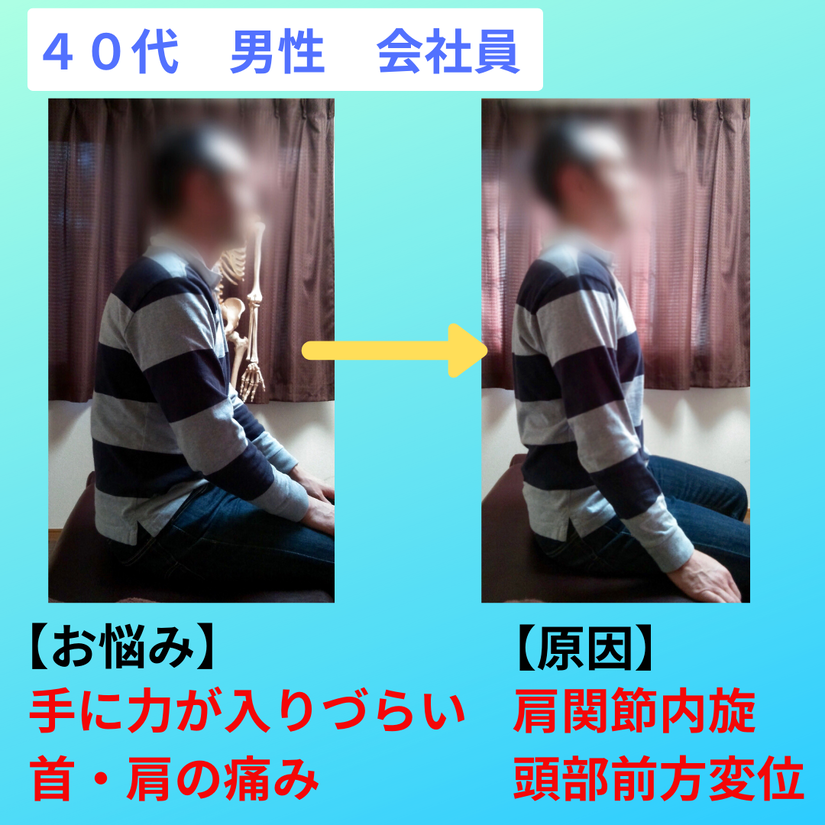 shoulder-pain-before-after.png
