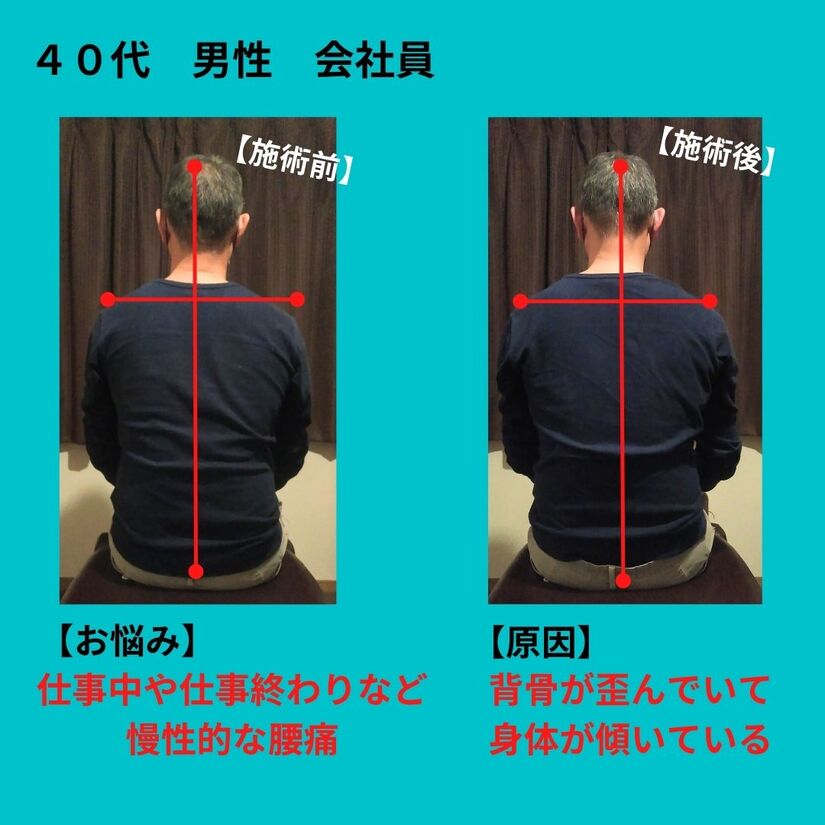 lower-back-pain.jpg
