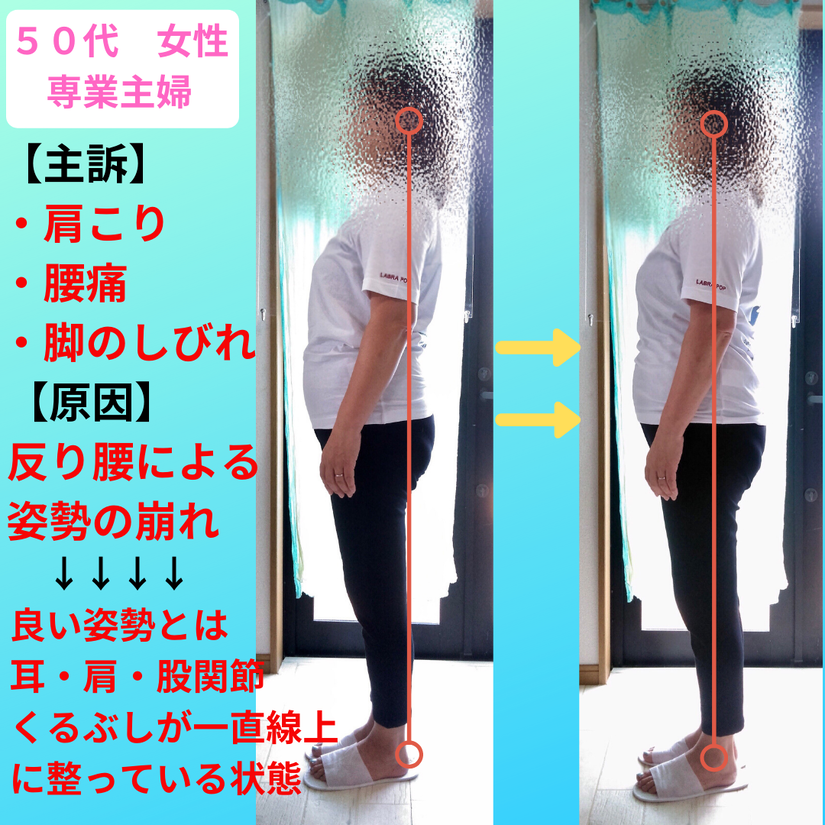 姿勢改善 湘南辻堂鵠沼整体 posture-improvement.png